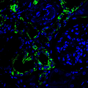 FADS1 Antibody