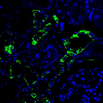 FADS1 Antibody