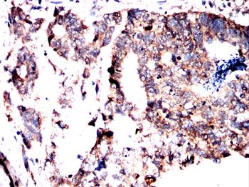 FADS1 Antibody