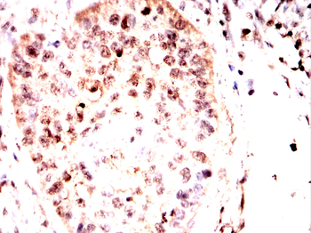 NCBP1 Antibody