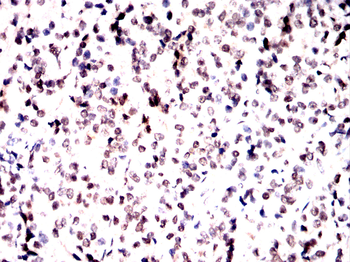 NCBP1 Antibody