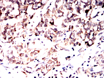 STIM1 Antibody