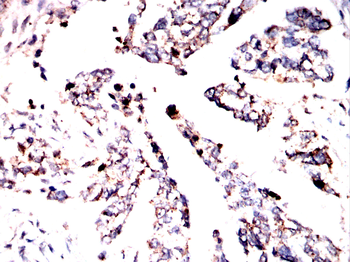 STIM1 Antibody
