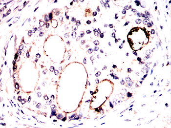 KDM1A Antibody