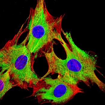 MUC16 Antibody