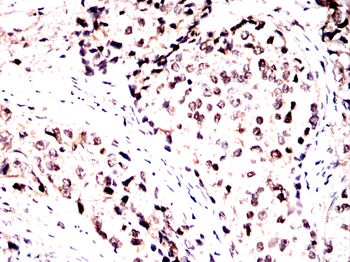 CASP7 Antibody