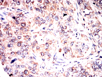 MTAP Antibody
