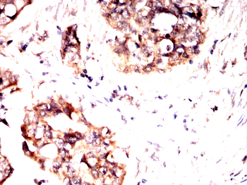 MTAP Antibody