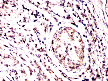 MTAP Antibody