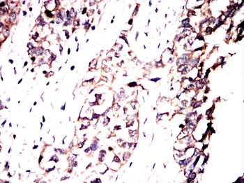 VASP Antibody