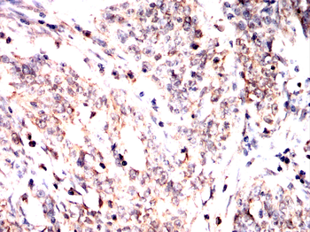 VASP Antibody