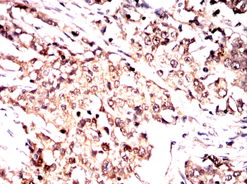 VASP Antibody