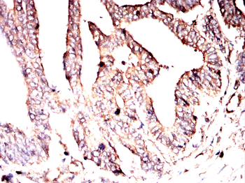 VASP Antibody