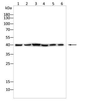 VASP Antibody