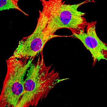 VASP Antibody