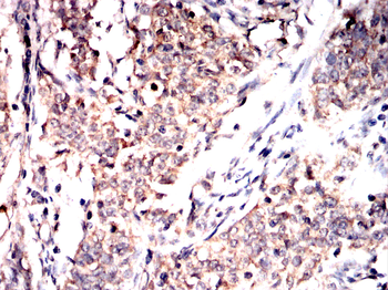 VASP Antibody