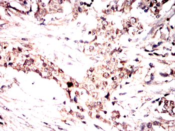VASP Antibody
