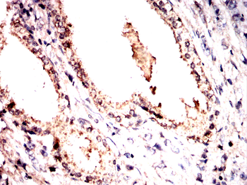 VASP Antibody