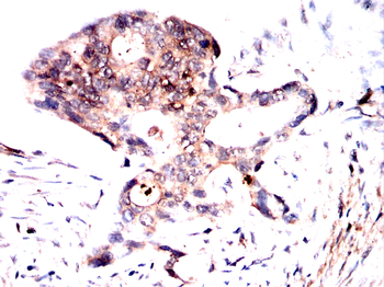 VASP Antibody