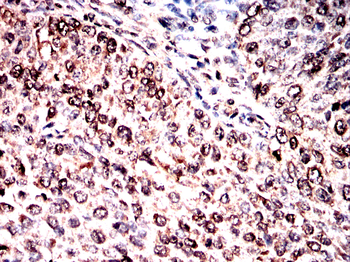 BNIP3L Antibody