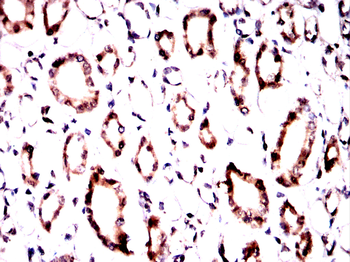 BNIP3L Antibody