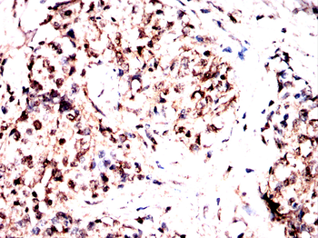 BNIP3L Antibody