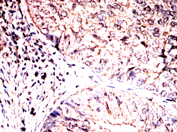 BNIP3L Antibody