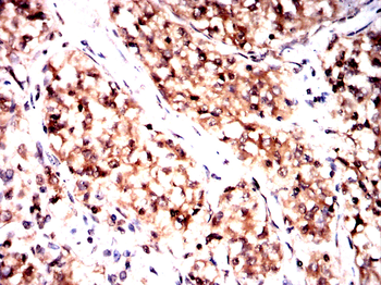 BNIP3L Antibody