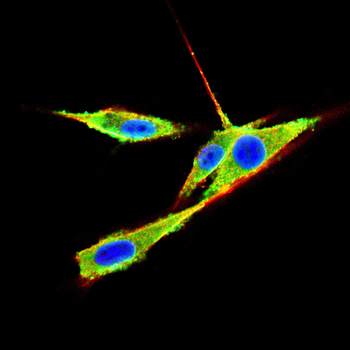 CCL5 Antibody