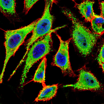 CCL5 Antibody