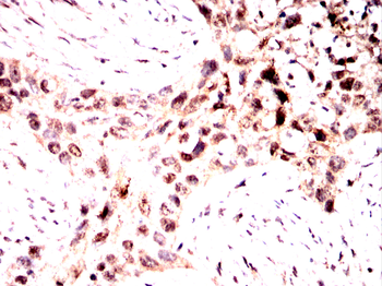 RNF2 Antibody