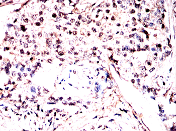 RNF2 Antibody