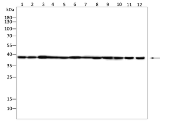 RNF2 Antibody