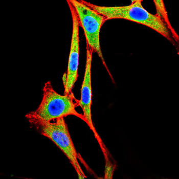 TGFBR1 Antibody