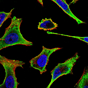 TGFBR1 Antibody