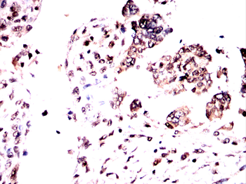 TGFBR1 Antibody