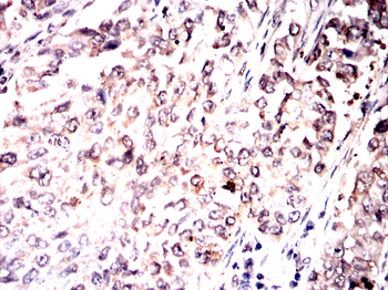 TGFBR1 Antibody