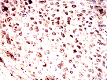 TGFBR1 Antibody