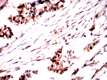 TGFBR1 Antibody