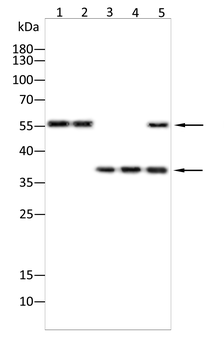 TGFBR1 Antibody