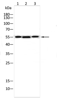 TGFBR1 Antibody