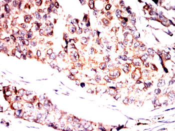AXL Antibody