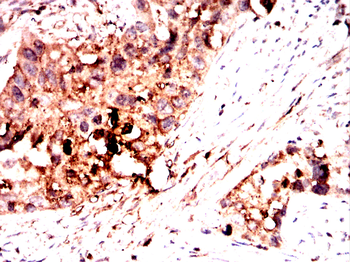 AXL Antibody