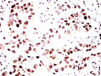 CCND2 Antibody