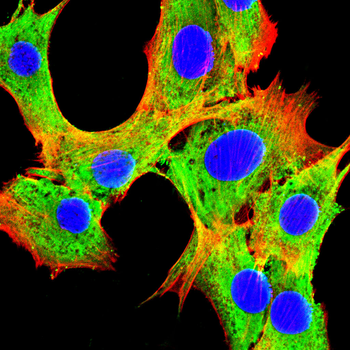 CHI3L1 Antibody