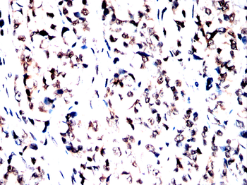 Cdkn2a Antibody