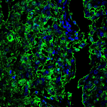 Cdkn2a Antibody