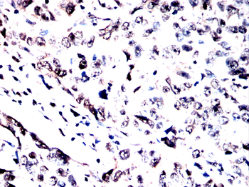Cdkn2a Antibody