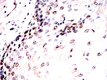 Cdkn2a Antibody