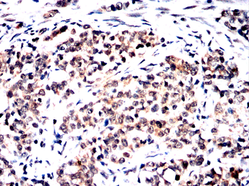Cdkn2a Antibody